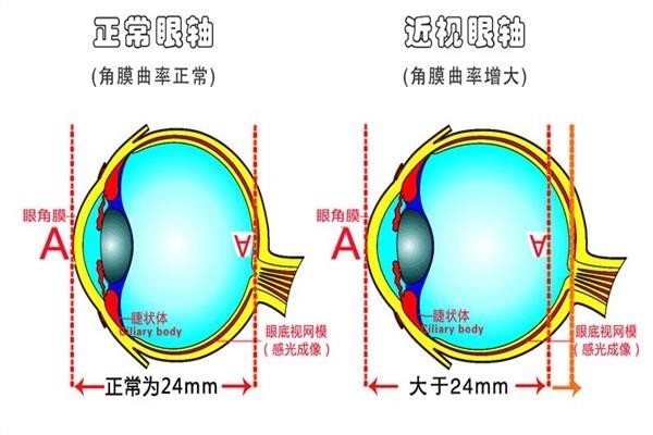 博視頓視力康復中心加盟