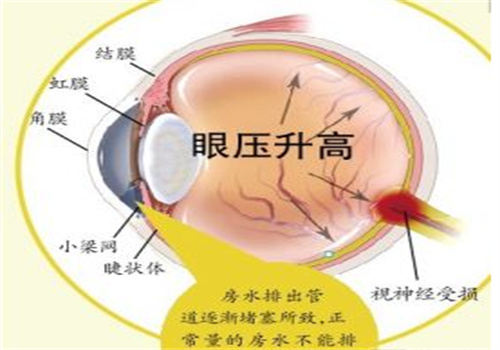 新視角專業(yè)矯治近視弱視加盟